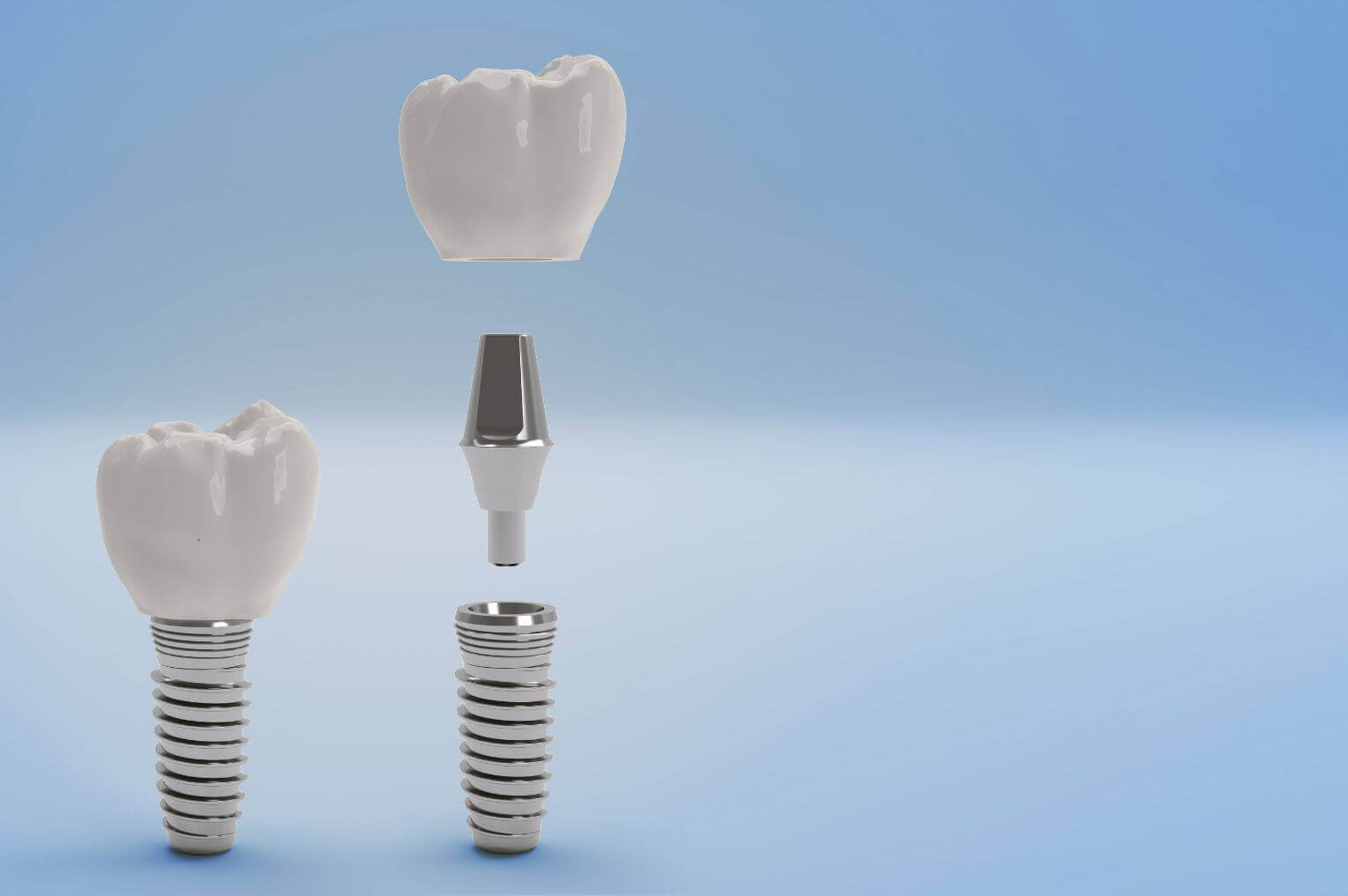 Dental implant demonstation on blue background for Marylebone Dental Practice