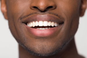 Man with composite bonding from our dentist at 19 Wimpole Street Dentist
