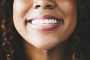 woman smiling after aesthetic dentistry at 19 wimpole street